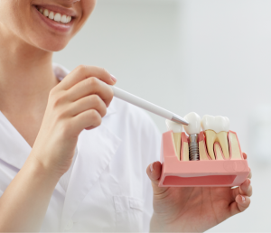 Crowns and Bridges Kandy