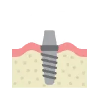 cayo-icon-dental-implant